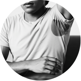 Tratamiento para la hiperhidrosis o sudoración excesiva en Tenerife